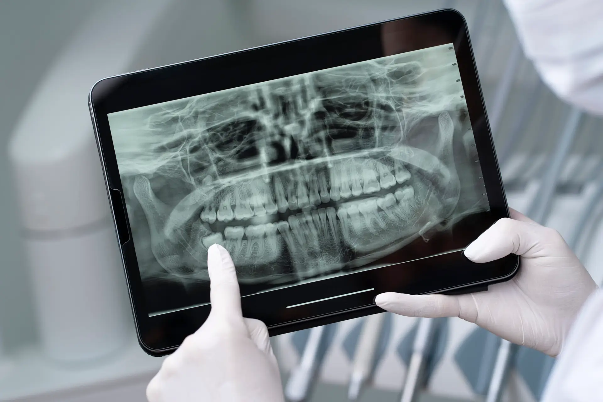Scanner 3D